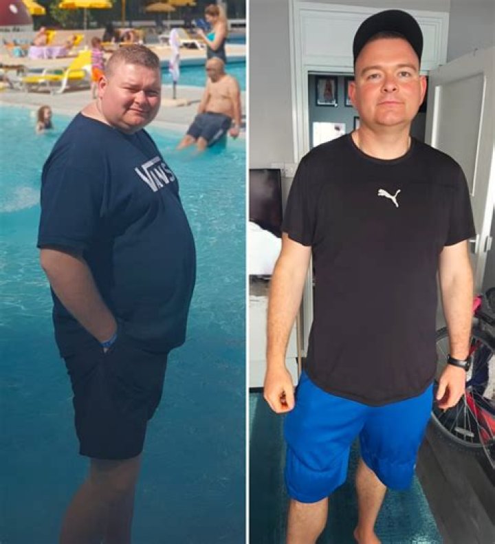 Does Jack Whitehall Have A Disability? Weight Loss Before And After