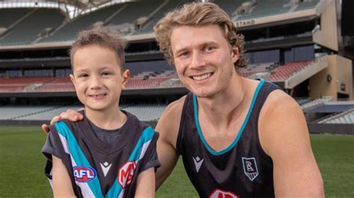
What Happened To Xavier Duursma? Updates On His Injury And Health 