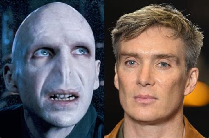 
What Has James Nesbitt Done To His Eyebrows? Details About The Actor’s New Look 